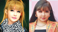10位自曝整容的韩国女星，刘仁娜李多海成功逆袭，朴春却肿成假人