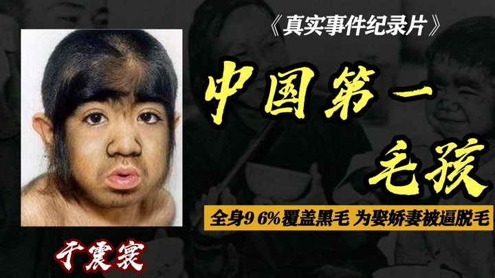 中国第一毛孩于震寰：42岁为娶娇妻被逼脱毛，结果怎样了？