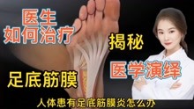 [图]医学探秘 人体患有足底筋膜炎 看医生如何利用手术进行治疗